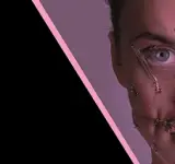 Προχωρημένες τεχνικές Βοτουλινικής Τοξίνης – Δερματικών Ενθεμάτων